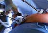 Tipos de cirurgia bariátrica