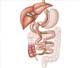 Cirurgia bariátrica bypass