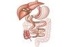 Cirurgia bariátrica Duodenal switch